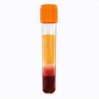 Separated plasma