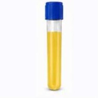 Final exosome-rich fraction
