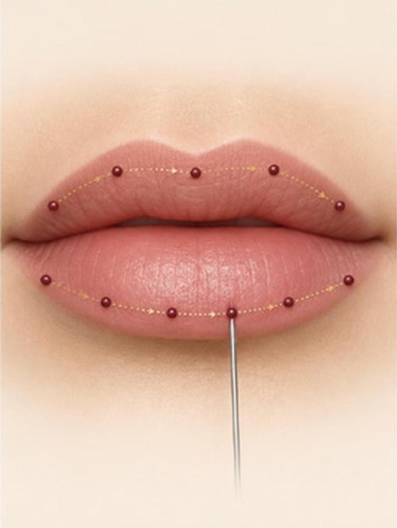 tuLip Booster micro-injection points